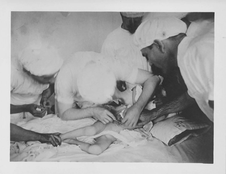 Imagens da cirurgia realizada em 30 de maio de 1900