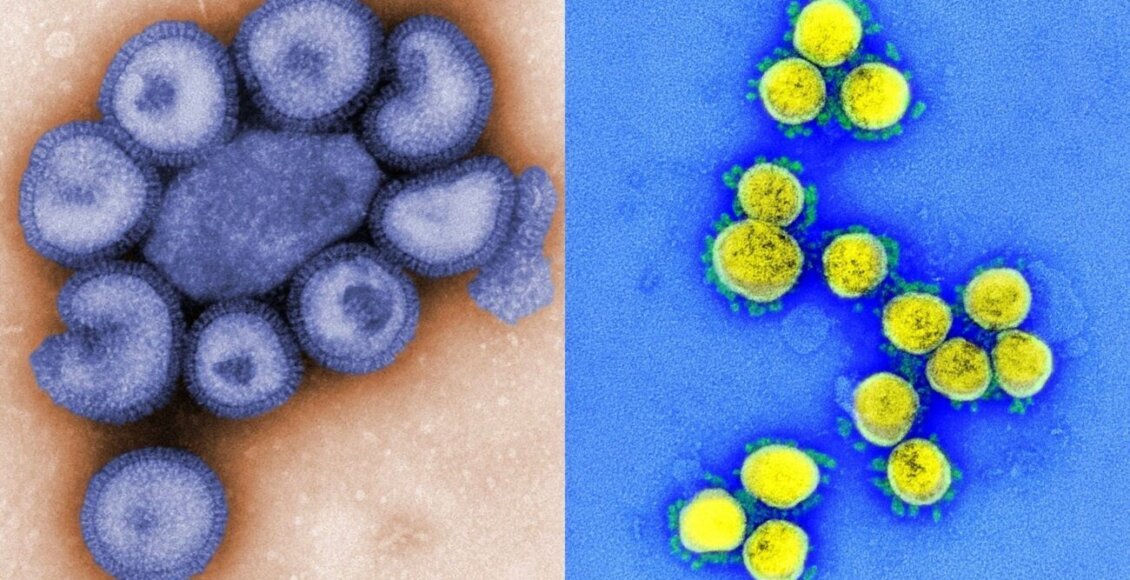 Flurona no RJ: sintomas da dupla infecção por Influenza e Covid