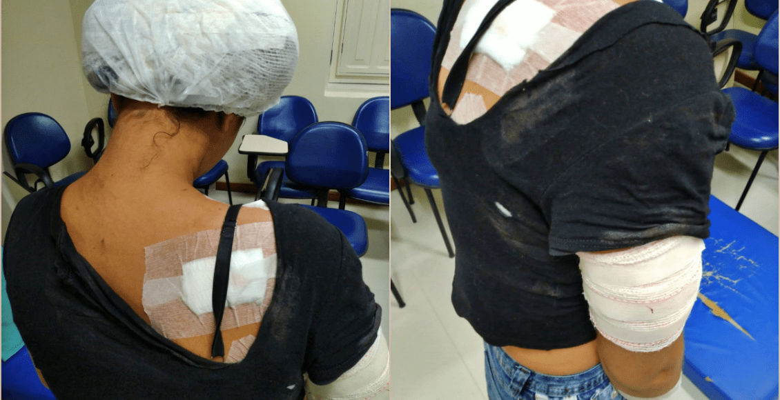 Homem que esfaqueou 14 vezes a companheira é preso em Carmo