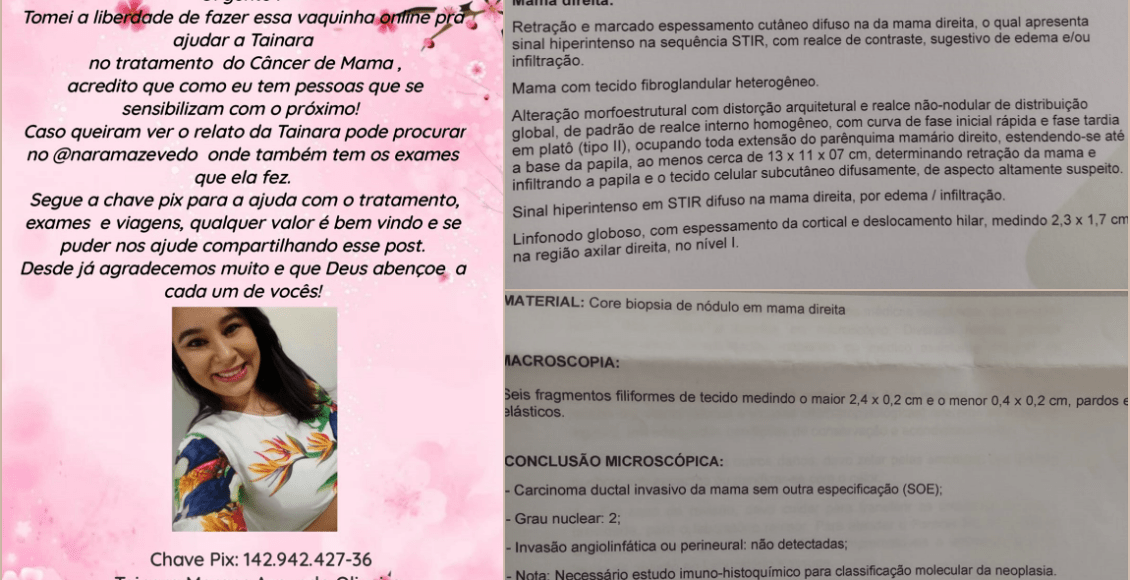 Moradora de Cantagalo pede ajuda para custear tratamento contra câncer