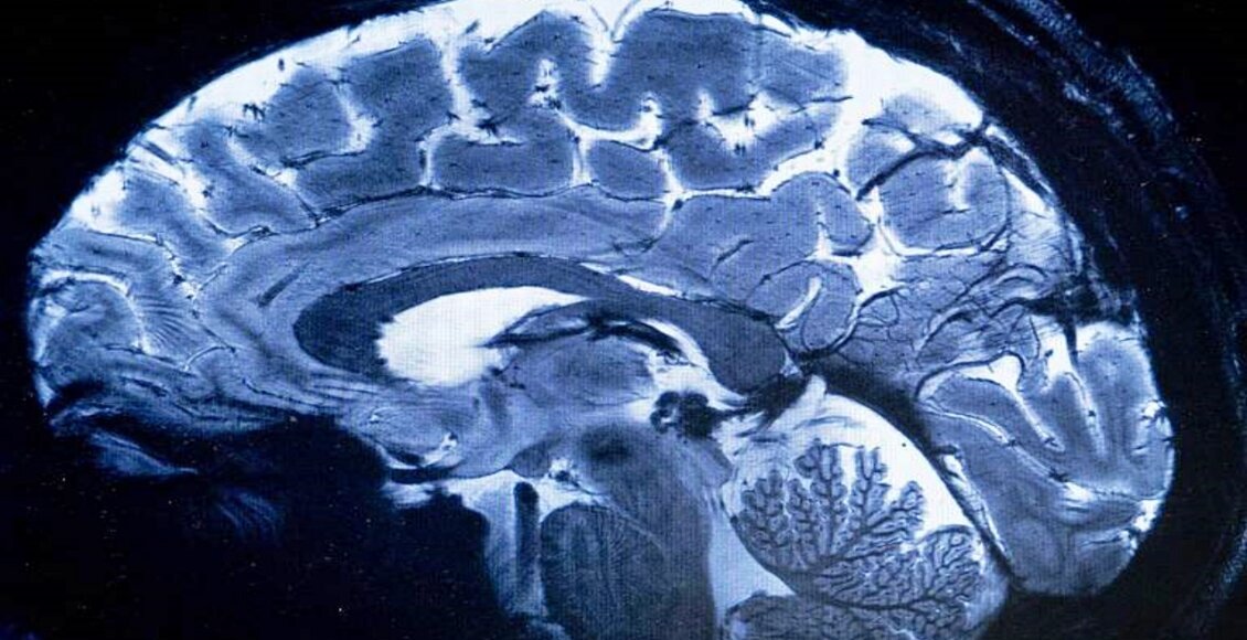 França lança scanner de ressonância magnética mais potente do mundo