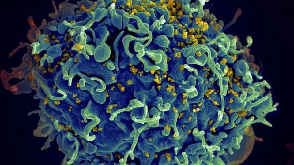 Nova variante do HIV é detectada no Rio de Janeiro