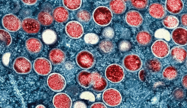 10 vezes mais letal: OMS declara mpox como emergência de saúde mundial