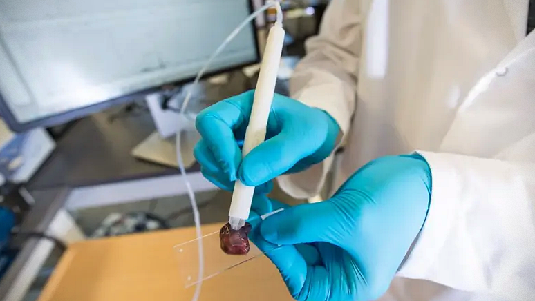 Cientista brasileira desenvolve caneta que detecta câncer em segundos